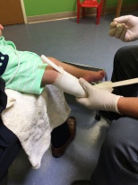 Here is Emmett getting a cast made for his orthotics. We hope this will help strengthen his legs so he can learn to stand eventually.
